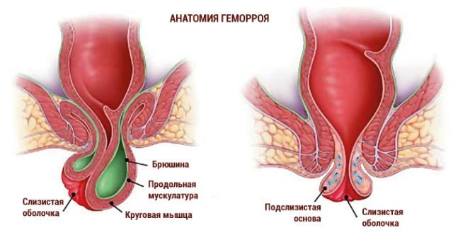 Народные рецепты: Горец почечуйный