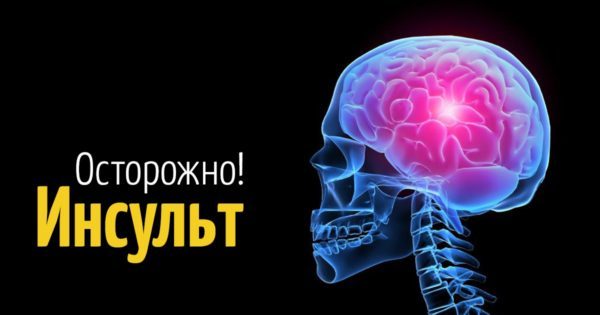 Сколько живут после инсульта - как жить после инсульта?