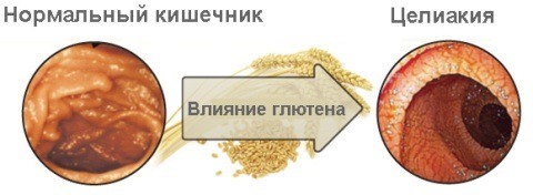Щелочная фосфатаза в крови повышена/понижена – что делать?