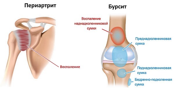 Индовазин мазь: инструкция, аналоги, показания к применению