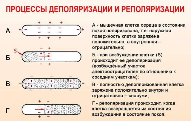 Синдром ранней реполяризации желудочков у ребенка