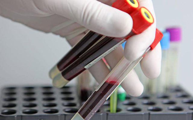 Липиды крови норма у женщин по возрасту таблица - Про холестерин