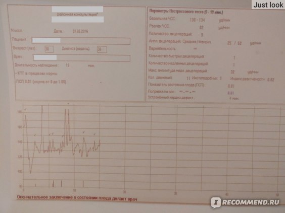КТГ при беременности — расшировка, норма и когда делают?