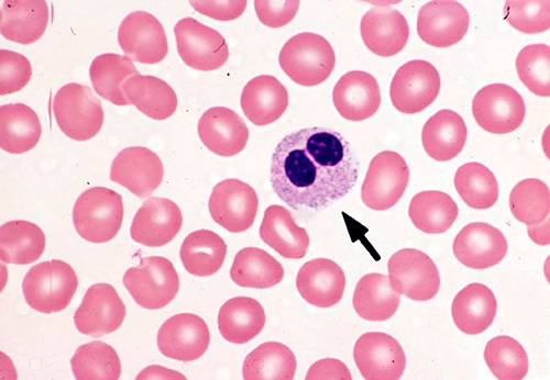 Если палочкоядерные нейтрофилы 0 у взрослого – о чем это говорит. Почему у ребенка повышены сегментоядерные и палочкоядерные нейтрофилы: причины высоких показателей в анализе крови