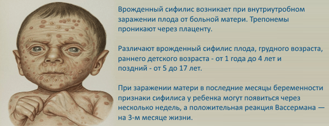 Сифилис у женщин – первые признаки, симптомы, лечение