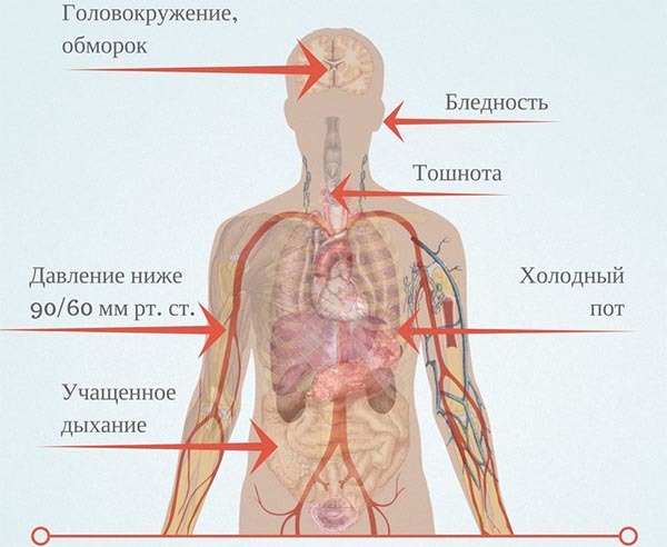Низкое диастолическое давление – причины и меры лечения
