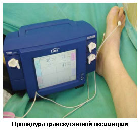 Как диабет влияет на ноги?