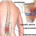 Тизалуд - инструкция по применению, описание, отзывы пациентов и врачей, аналоги