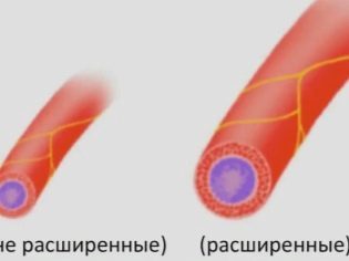 Эритема у детей и взрослых: симптомы, фото, лечение