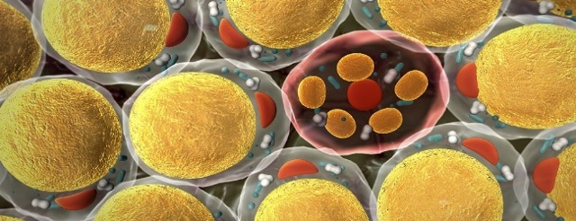 Повышенный холестерин в крови: что это значит, причины, лечение и симптомы у женщин и мужчин