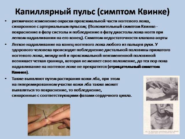 Характеристика пульса: основные показатели нормы