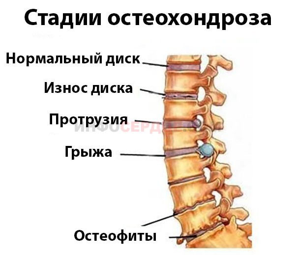 Что делать, если беспокоит жжение в области сердца