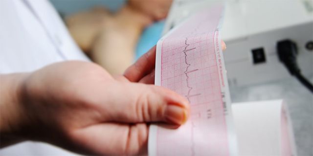 Пароксизмальная мерцательная аритмия: причины, лечение