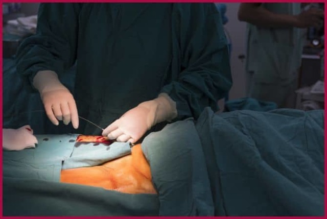 Предсердная экстрасистолия: какие симптомы, причины и лечение