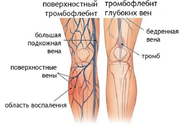 Народные рецепты: Горец почечуйный