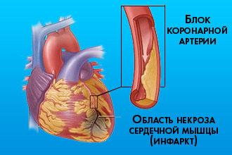 Пульс у спортсменов при нагрузке - Все про гипертонию