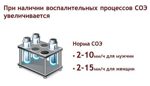 Норма СОЭ в крови у женщин