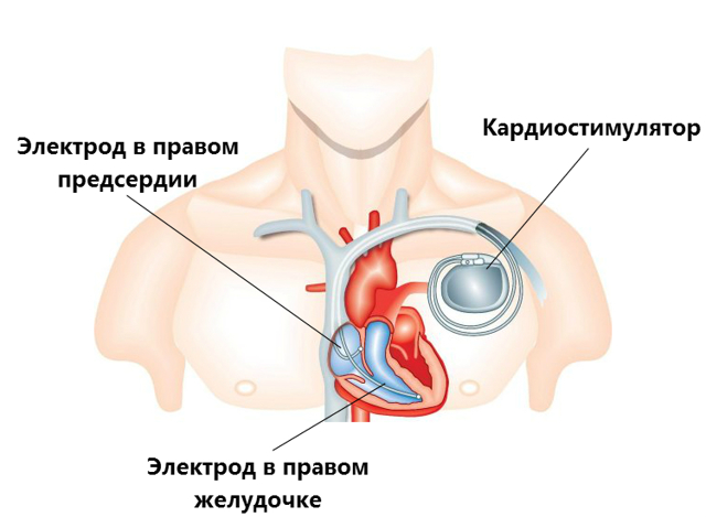 Причины высокого пульса у мужчин - Всё о сердце