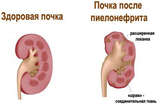 Боли под грудью: причины, диагностика и лечение