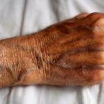 На лице видны вены что делать » Полезный блог обо всем