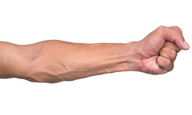 Флебит вены на руке. Лечение постинъекционного флебита после катетера