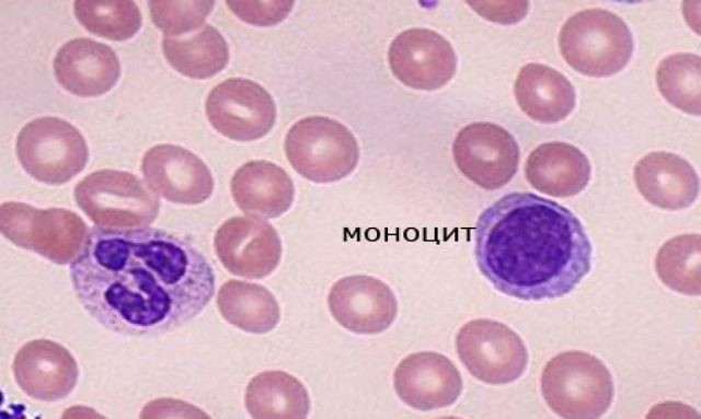 Моноциты в крови повышены