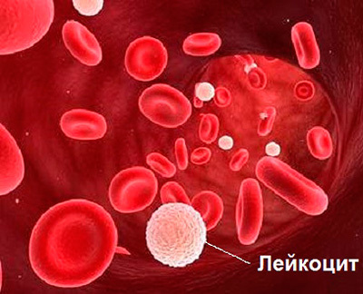 Норма лейкоцитов в крови у женщин: особенности и причины отклонений