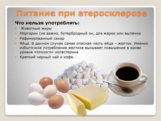 Как убрать атеросклероз - Про холестерин