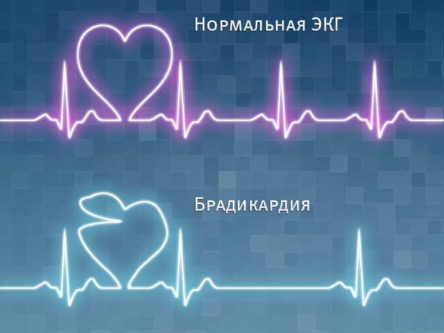 Почему после физической нагрузки частота пульса увеличилась - Все про гипертонию