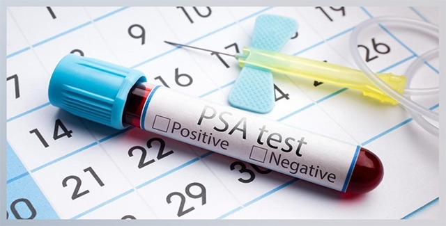 Анализ крови ПСА — что это такое? Расшифровка и норма