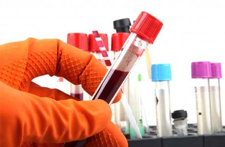 Креатинин в крови повышен: причины отклонения от нормы и способы снижения уровня креатинина