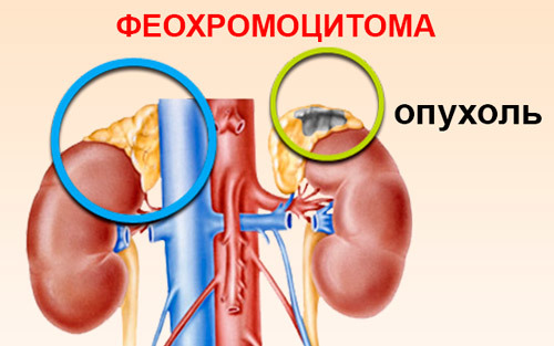 Первая помощь при кровотечении из носа: как правильно оказать медицинскую помощь (алгоритм) при сильном кровотечении, что нужно делать чтобы из носа пошла кровь без боли