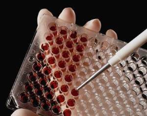 Anti hcv подтверждающий положительный что это значит — Лечим печень