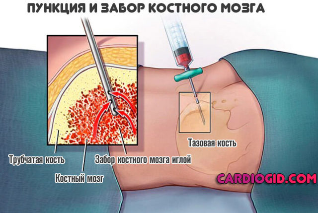 Анализ крови на МНО: показания, норма, расшифровка