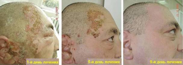 Стелланин мазь - цена, отзывы и эффективность