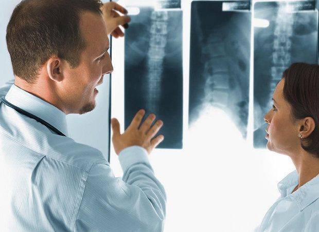 Инсульт спинного мозга (спинальный): симптомы, лечение, последствия