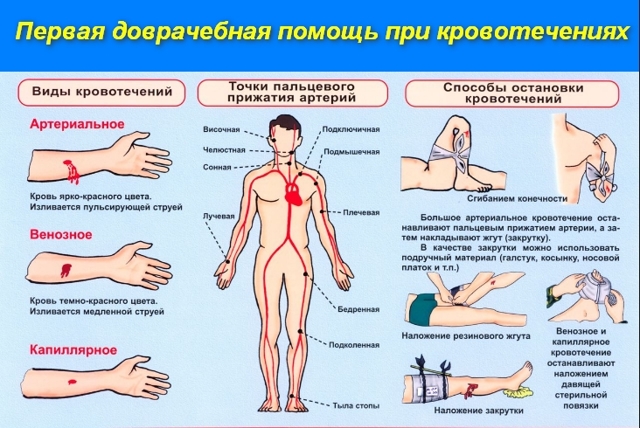 Первая помощь при кровотечениях