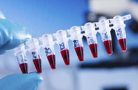 Повышены тромбоциты и повышены лимфоциты