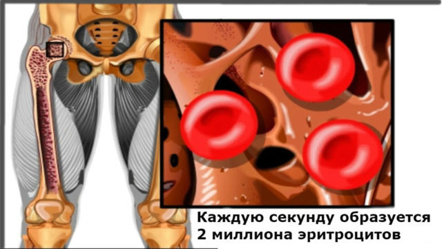 Что такое Эритремия?