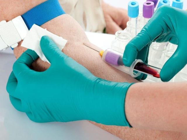 КИСЛОТНАЯ И ОСМОТИЧЕСКАЯ УСТОЙЧИВОСТЬ ЭРИТРОЦИТОВ ПЕРИФЕРИЧЕСКОЙ КРОВИ ЧЕЛОВЕКА ПРИ ДЕЙСТВИИ СТРЕССОВЫХ ФАКТОРОВ РАЗЛИЧНОГО ГЕНЕЗА - Современные проблемы науки и образования (научный журнал)