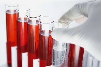 Анализ на гормоны у женщин: таблицы нормы, расшифровка анализа крови