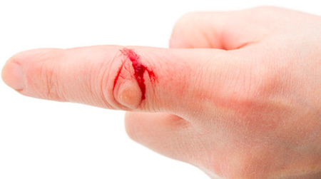 Функции лейкоцитов – за что отвечают? - Диагностика