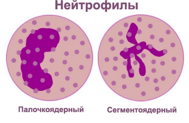 Нейтрофилы в крови понижены у взрослого, о чем это говорит