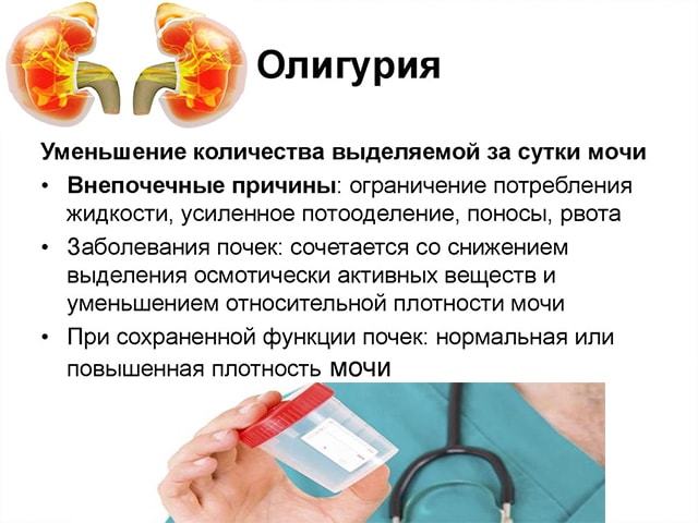 Причины, признаки и лечение олигурии