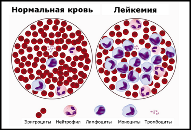 Профилактика лейкоза, Меры борьбы с лейкозом - Лейкоз скота