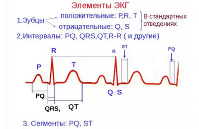 Нерегулярный синусовый ритм сердца