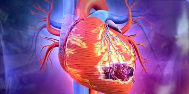 От чего происходит инфаркт миокарда