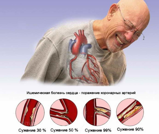 Предобморочное состояние: что это и почему это происходит? - Красота и здоровье - Статьи