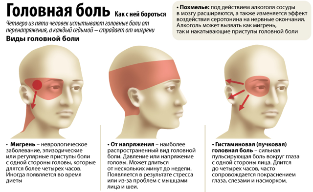 Боли в голове при всд характер течения и методы терапии