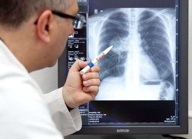 Характерные симптомы легочной гипертензии и схемы лечения